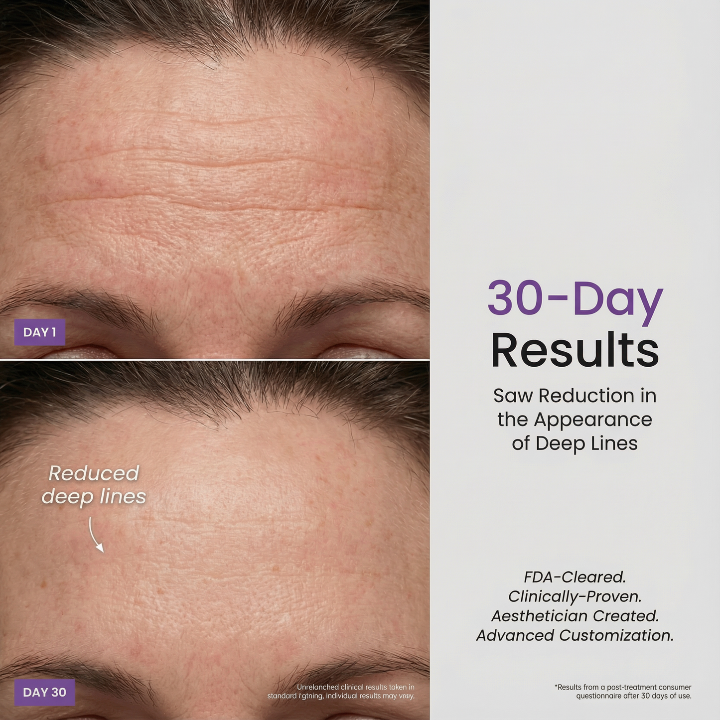 Microcurrent Facial Device