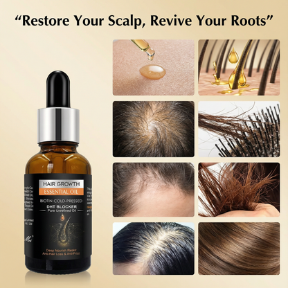 Bioten DHT-Block Growth Oil