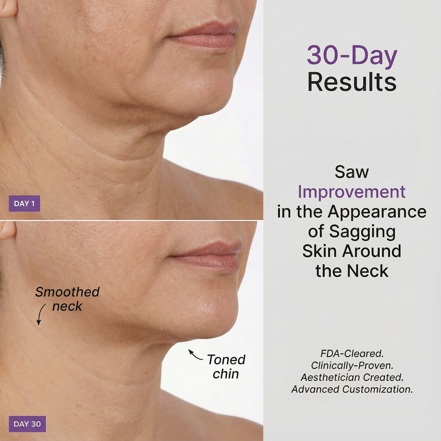 Microcurrent Facial Device